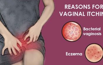 Vaginal Eczema Symptoms